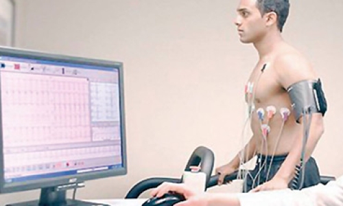 electrocardiográfico pruba de ejerccio